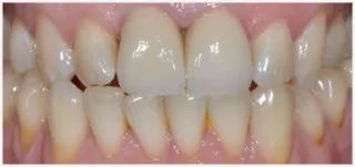 Implants · case 3: before treatment