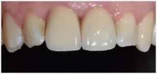Implants · case 4: before treatment