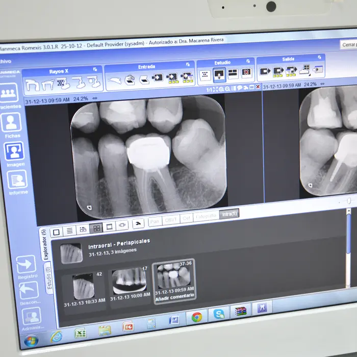 Low-radiation digital X-rays