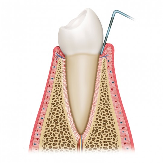 https://www.elitedental.cl/home/wp-content/uploads/2016/05/periodoncia01-540x540.jpg